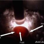 How to Determine Fertility of Crested Gecko Eggs